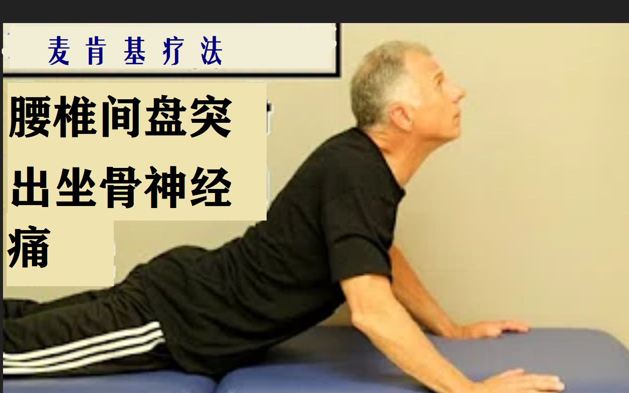 bobbrad麦肯基疗法针对腰椎间盘突出和坐骨神经痛中字