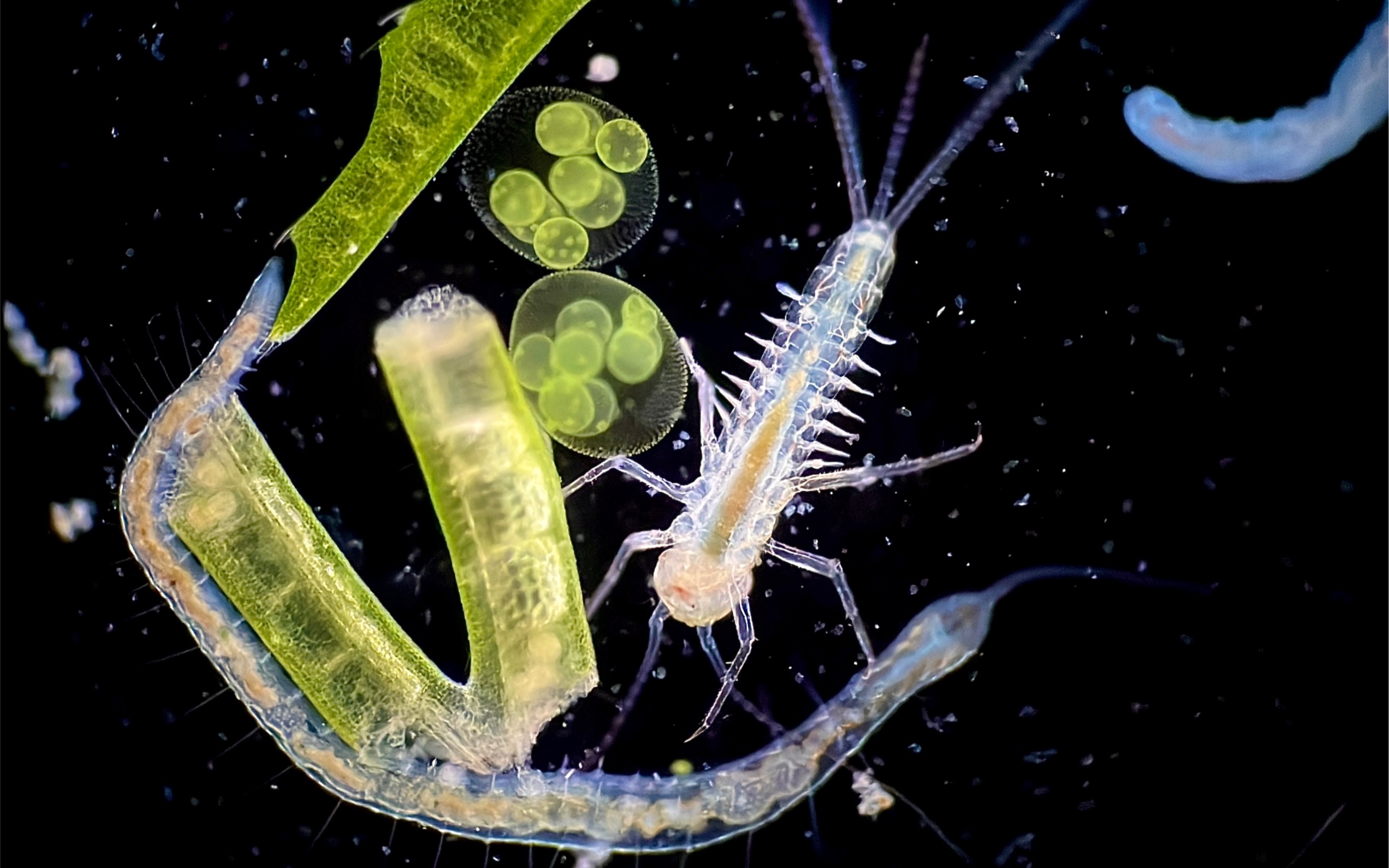 [图]初冬湖水的微生物观测（二）