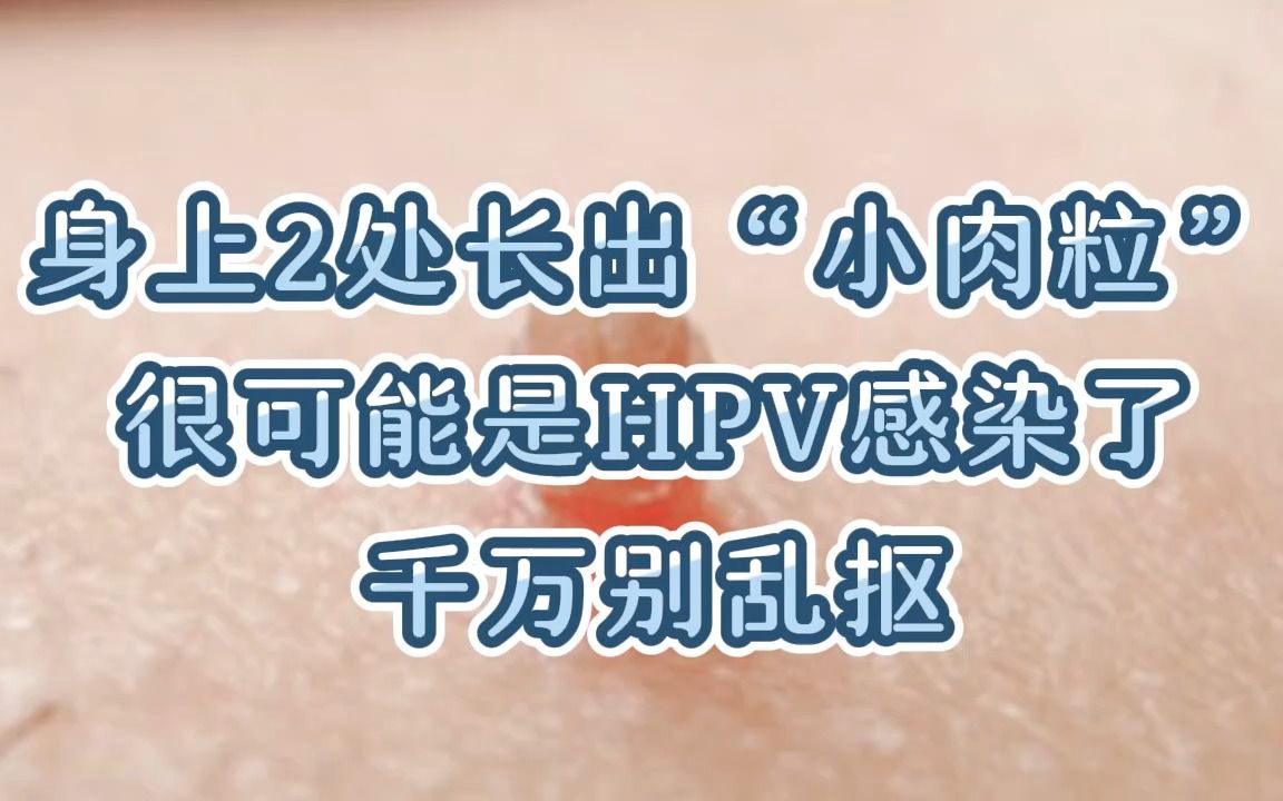 身上2处长出"小肉粒,很可能是hpv感染了,千万别乱抠