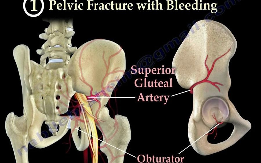 [图]骨科急症 Orthopaedic Emergencies  - Part 1