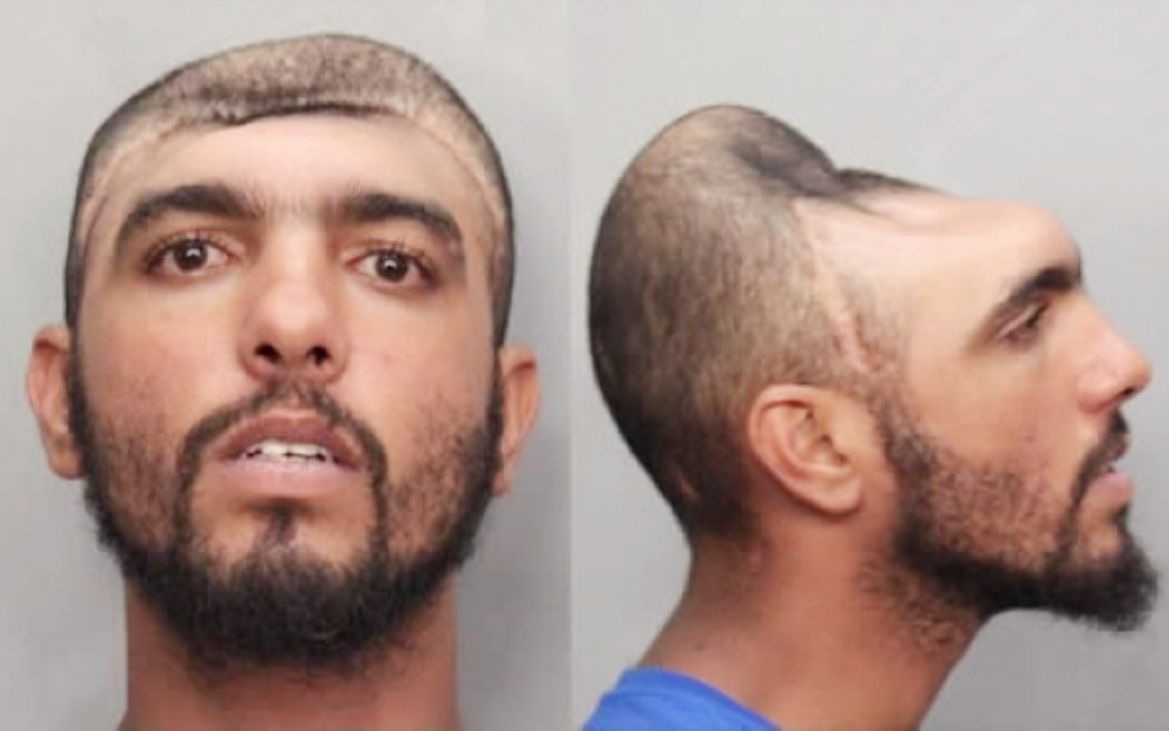 只剩半个头的坏小子从小混混瞬间变成网红