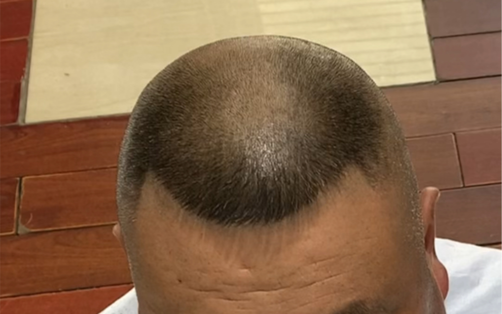 马蹄发型讲解分享