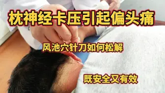 下载视频: 枕神经卡压引起偏头痛，冈池穴针刀如何松解，既安全疗效又好