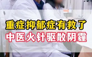 Video herunterladen: 重症抑郁症有救了 中医火针驱散阴霾