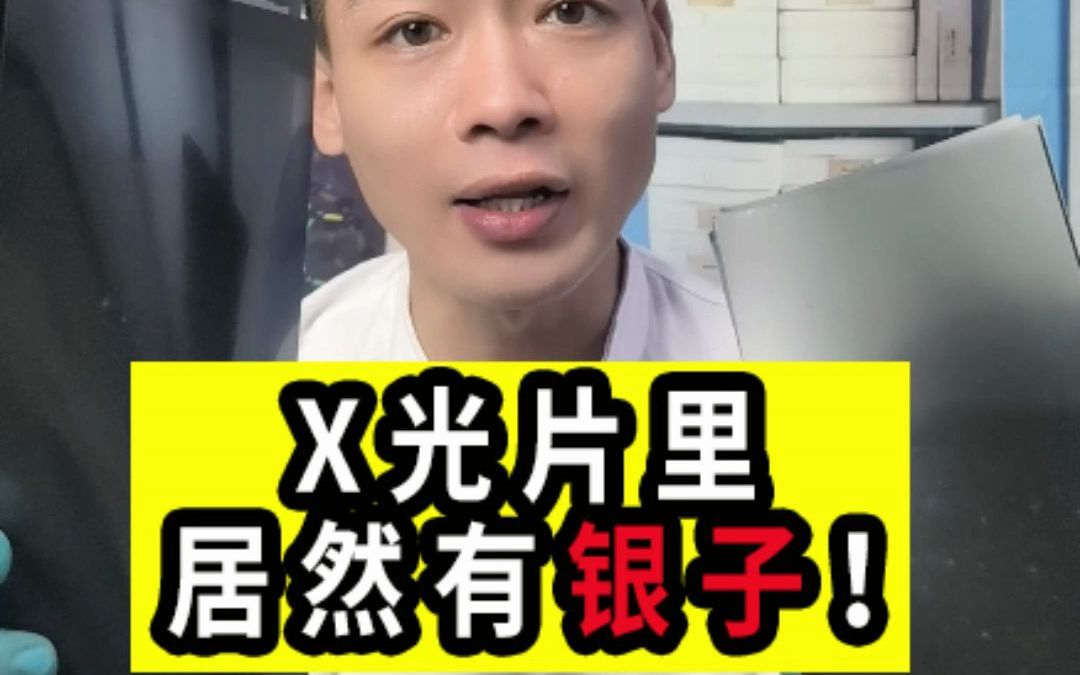 没想到吧!X光片里含有银子!来看看大金能提出多少来哔哩哔哩bilibili