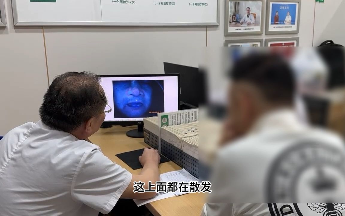 成都看白癜风医院哪个好:柯鹏飞医生认真的给患者讲解