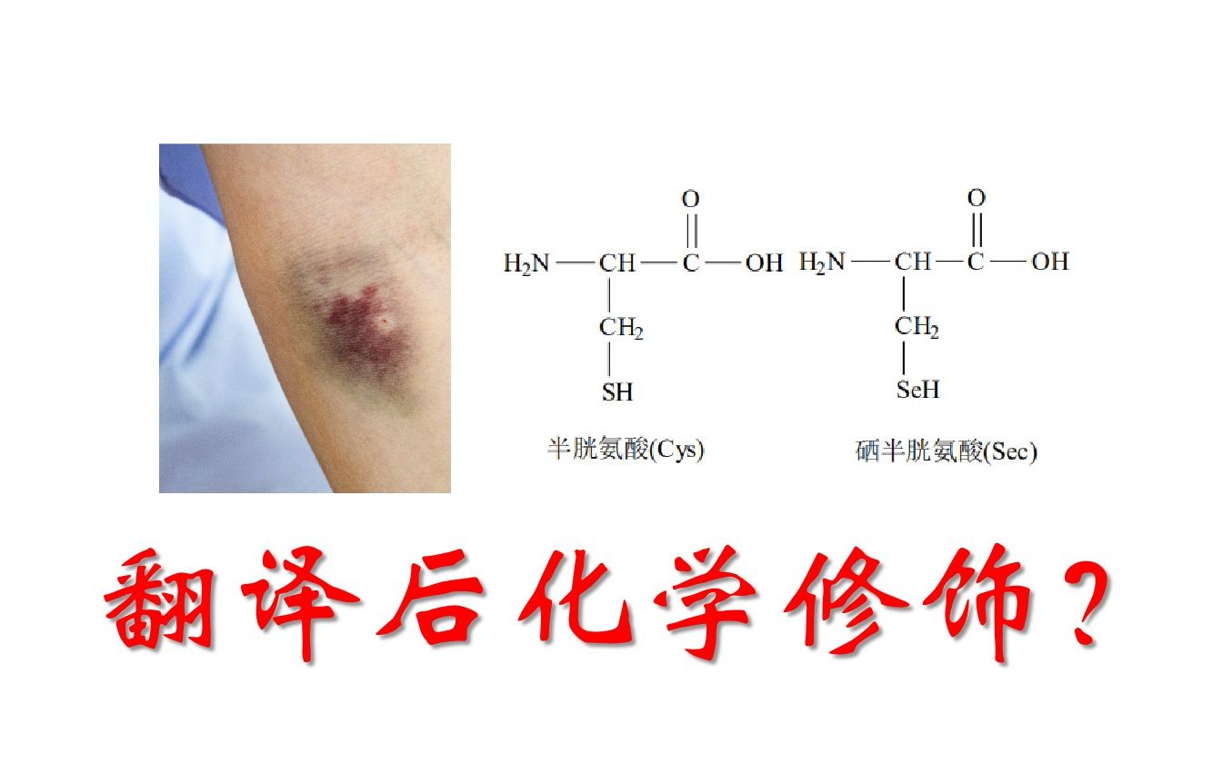 为什么皮肤经常有淤青可能是维C缺乏?翻译后化学修饰有哪些?硒代半胱氨酸是翻译后修饰而成的吗?哔哩哔哩bilibili