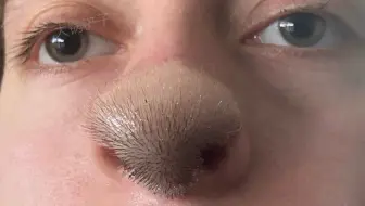 鼻子上长头发的人