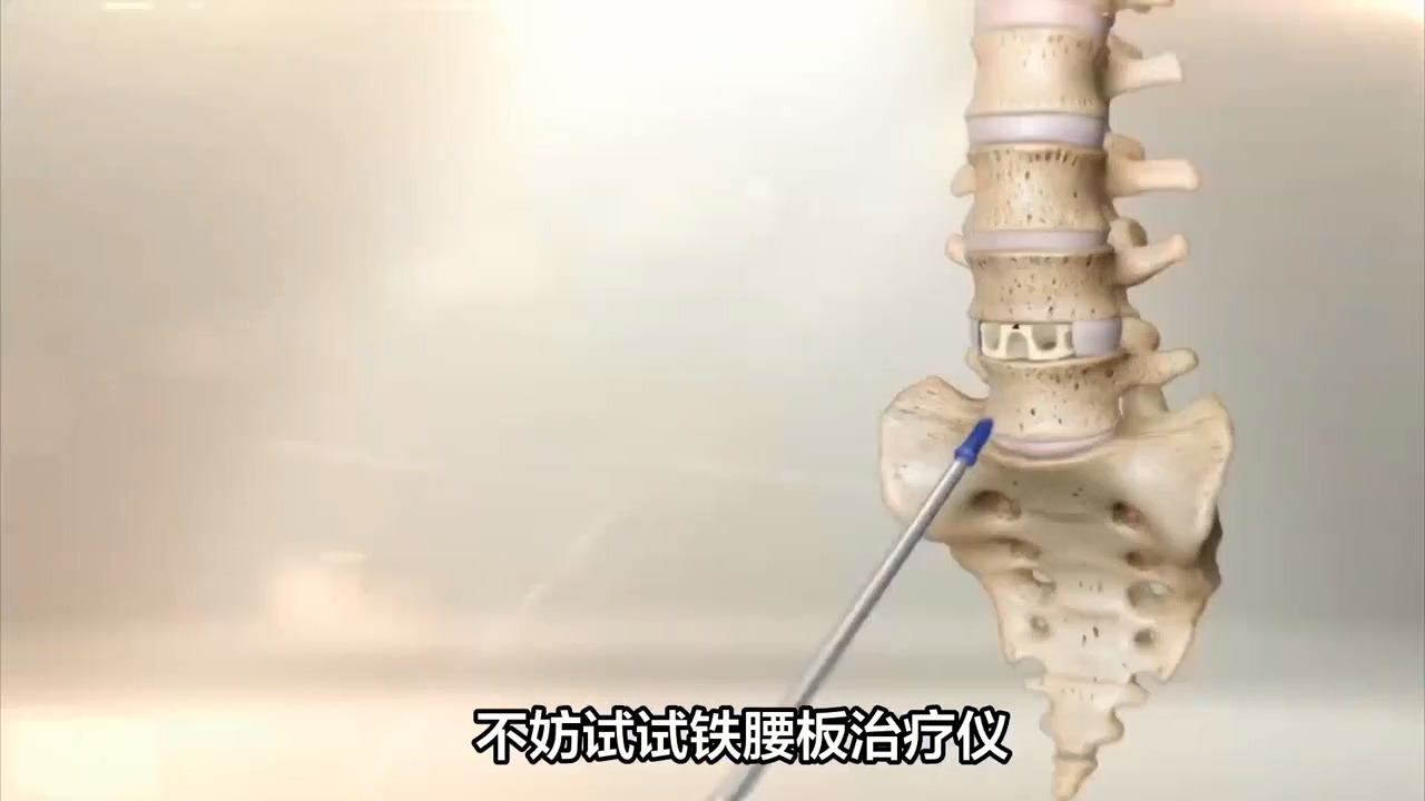 从疼痛中解放!我的铁腰板治疗腰椎间盘突出之路