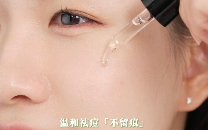 丽可植小绿瓶祛痘精华液 天然植萃 科学配方哔哩哔哩bilibili