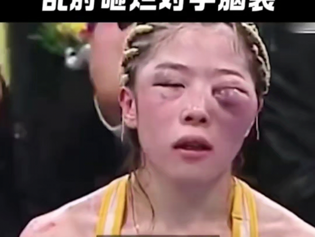 张伟丽vs日本女拳王