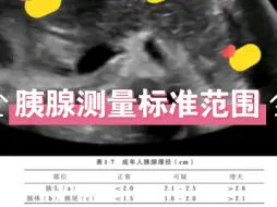 下载视频: 胰腺炎超声表现