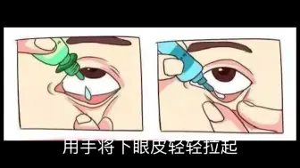 Tải video: 眼药水应该怎么滴