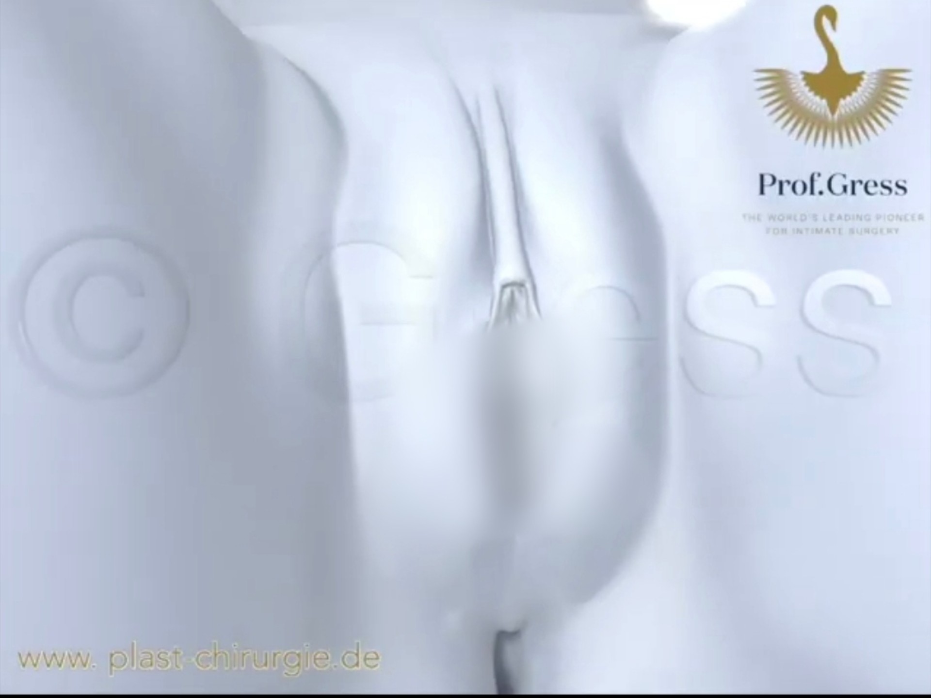 这这样的手术您会做吗，小阴唇延长术，3D演示。。