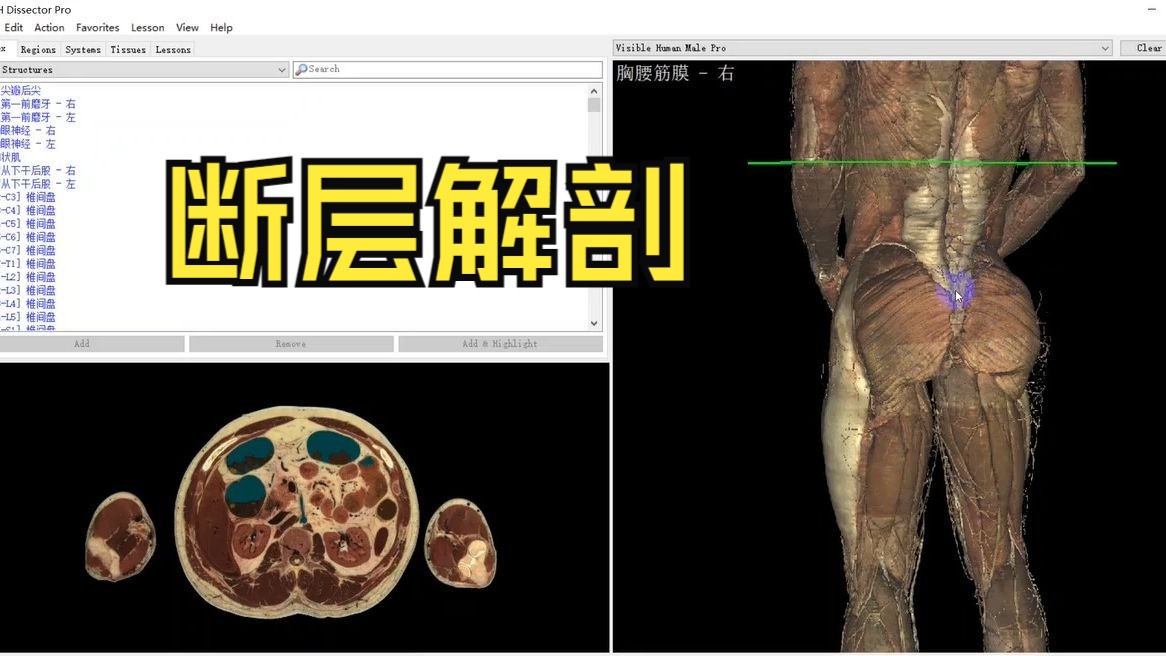 [图]医学解剖学及断层学习神器