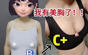 Descargar video: B-C+，我有美胸了！！！只需要300cc脂肪【北京隆胸李春财】