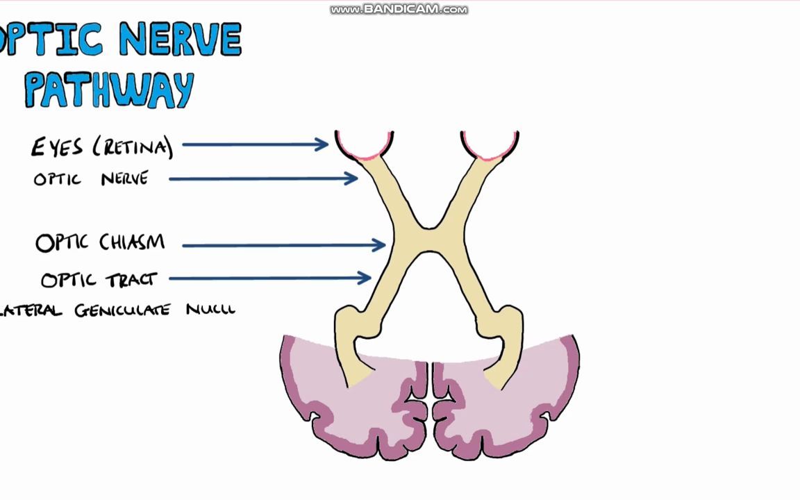 visualfielddefectsandopticnervepathway视野缺损和视路
