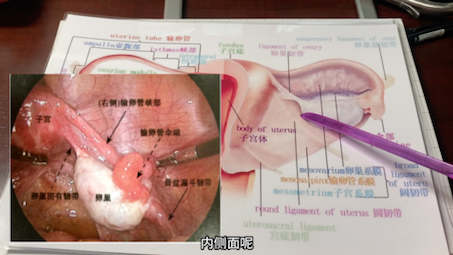 [图]生殖系统解剖学，妇科腹腔镜的必备基础