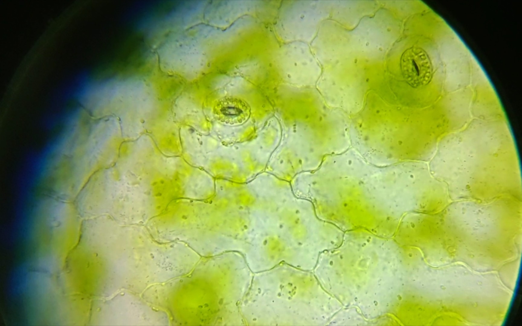 圣诞伽蓝菜叶片下表皮400倍镜