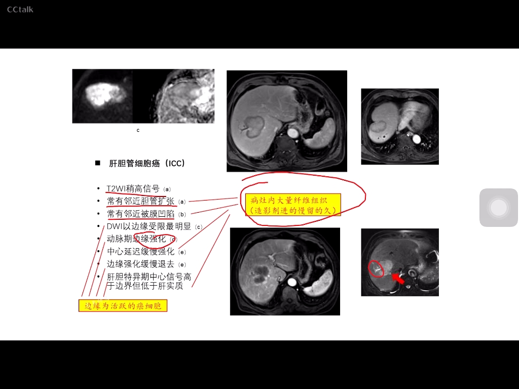 [图]天天师兄读片班