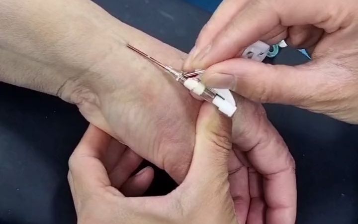 留置针单手退针.