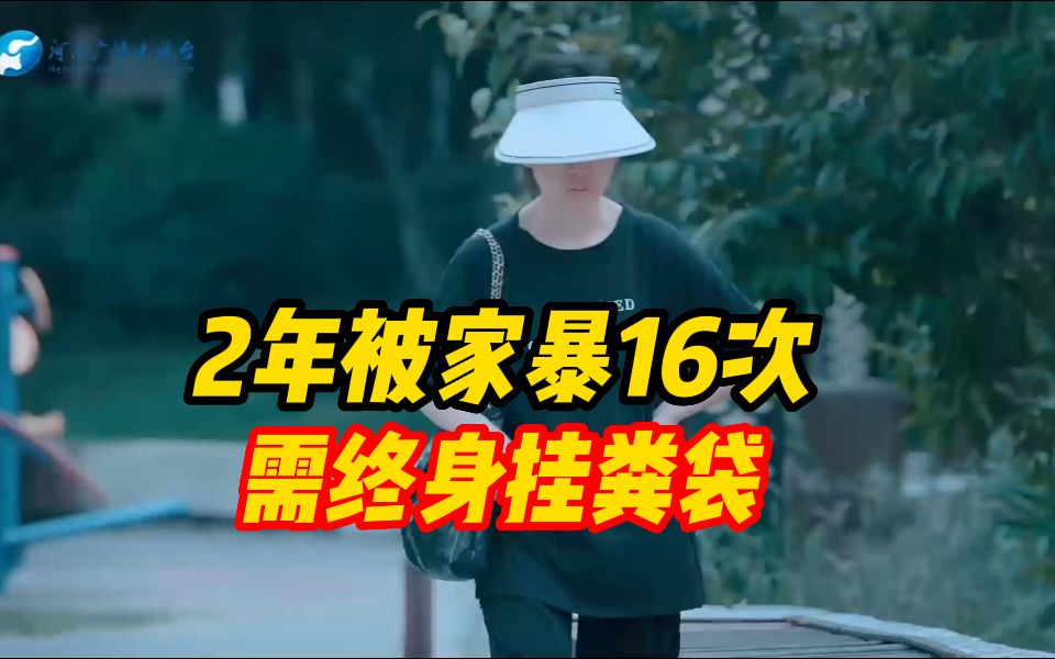 被家暴16次需终身挂粪袋!当事人:左肾没有功能了哔哩哔哩bilibili