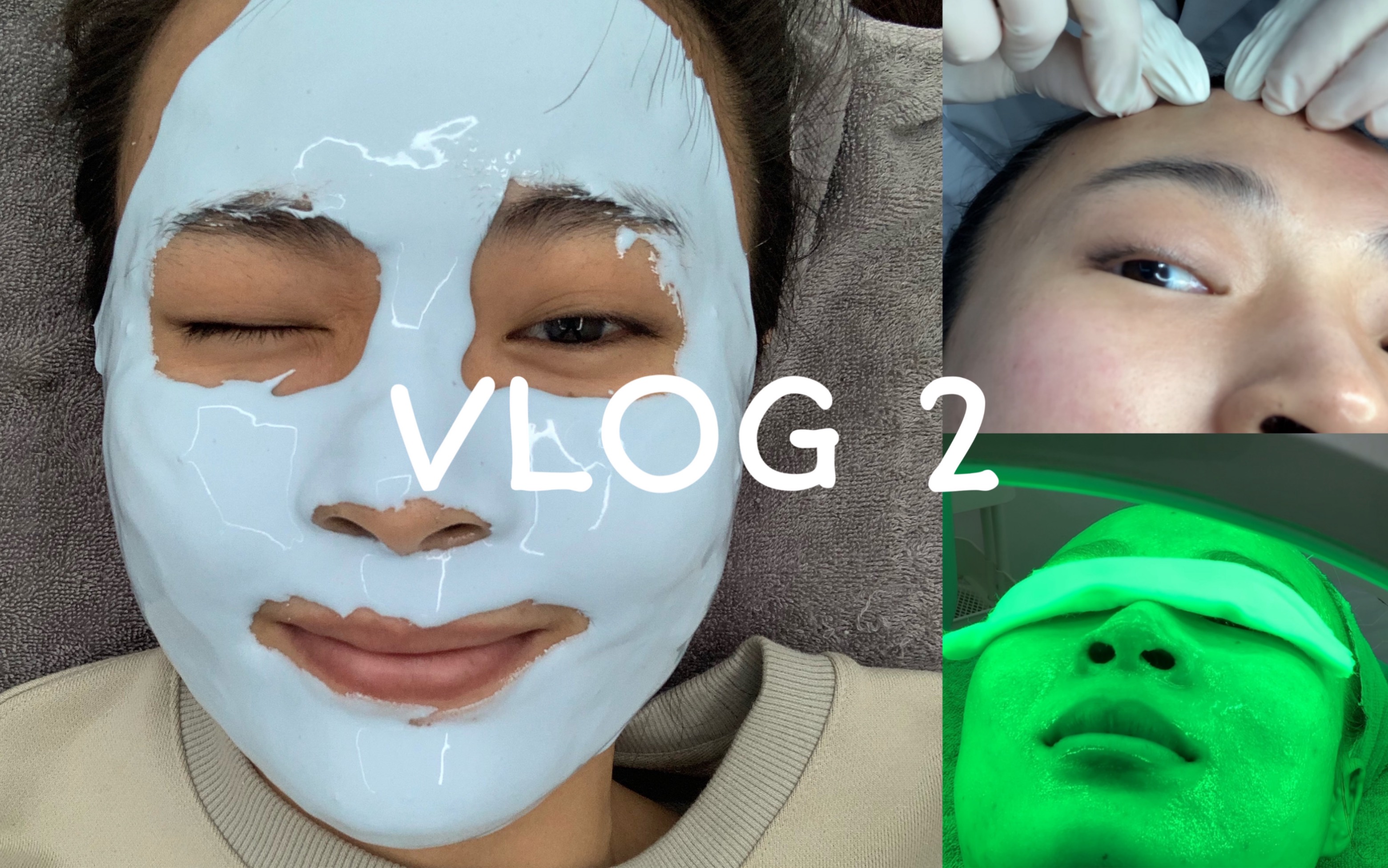 [图]【蛋仔】针清VLOG！祛痘修复好物分享！针清流程实录：补水/照光/针清