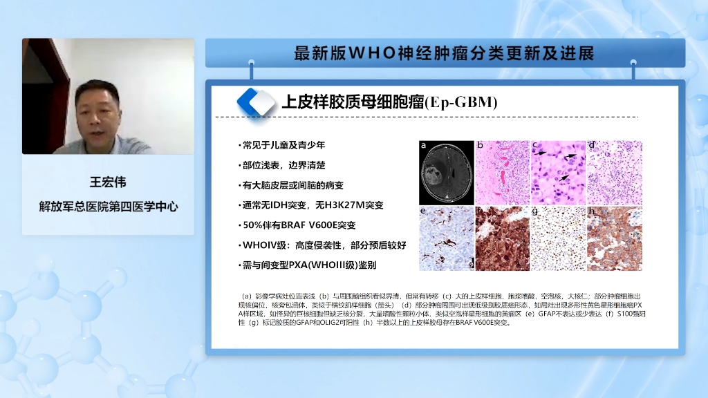 [图]国家级放射诊断学神经系统影像诊断（53讲）