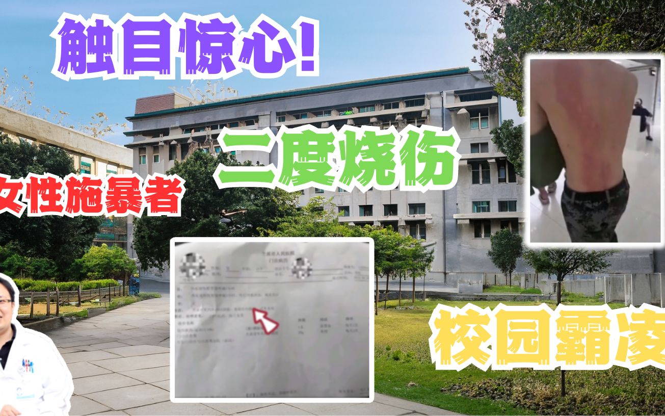 【医学与社会热点】第01期:某三本高校新生军训时女生恶意泼热水烫伤男生,校园霸凌何时休?法律如何定罪?该校通报:施暴女生留校察看处分哔哩哔...