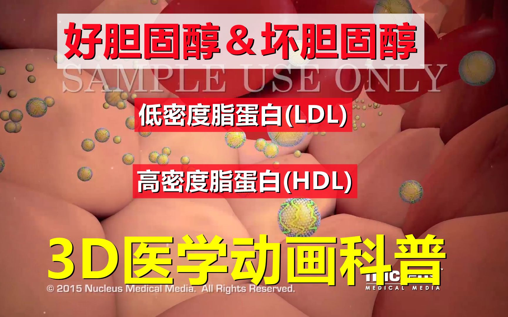 【3D医学动画科普】好胆固醇(HDLC)和坏胆固醇(LDLC)(中英双语字幕)哔哩哔哩bilibili