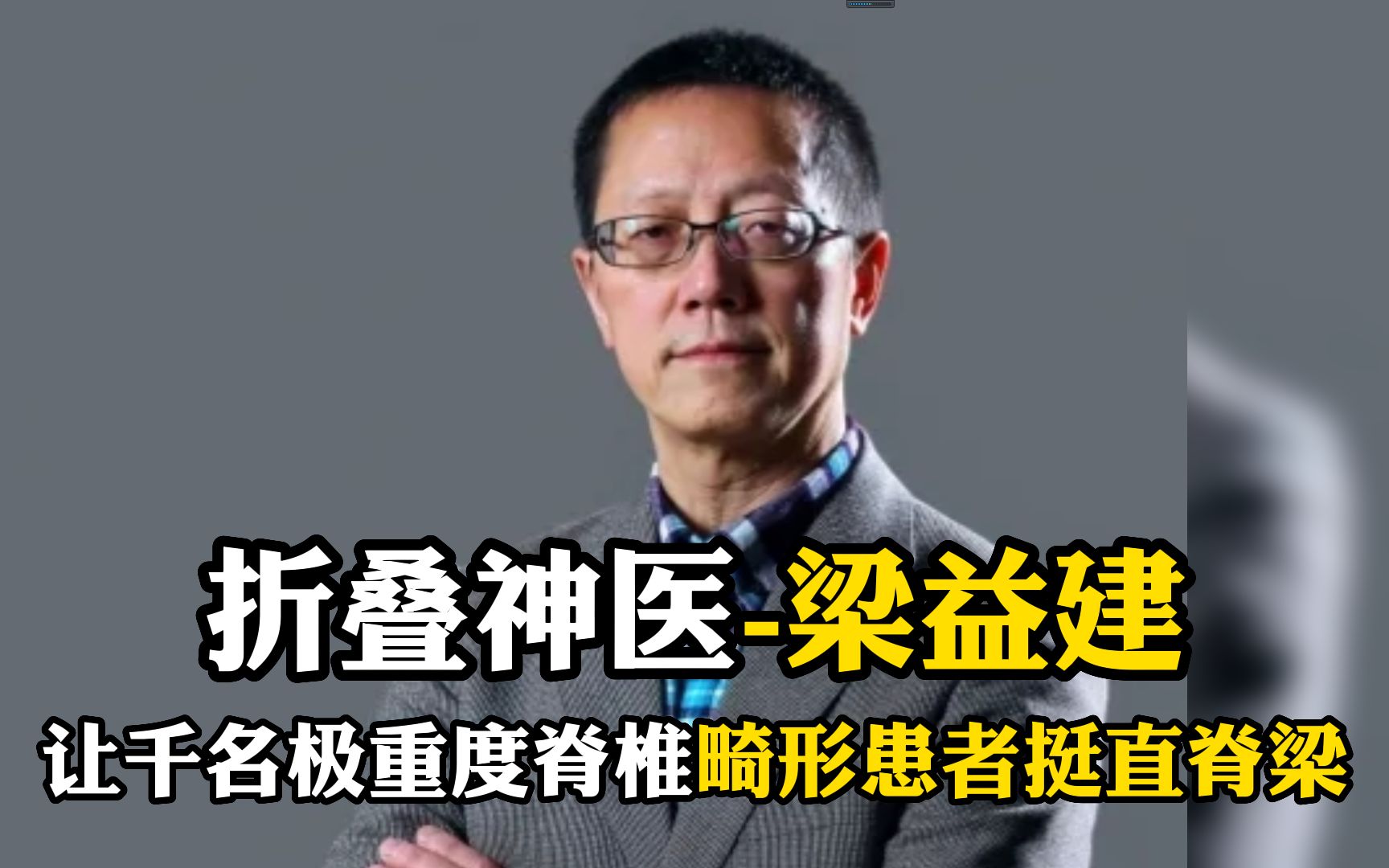 折叠神医梁益建,让千名极重度脊椎畸形患者挺直脊梁哔哩哔哩bilibili