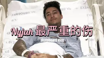 关于滑手Nyjah huston受过最严重的伤【SP中英文字幕】