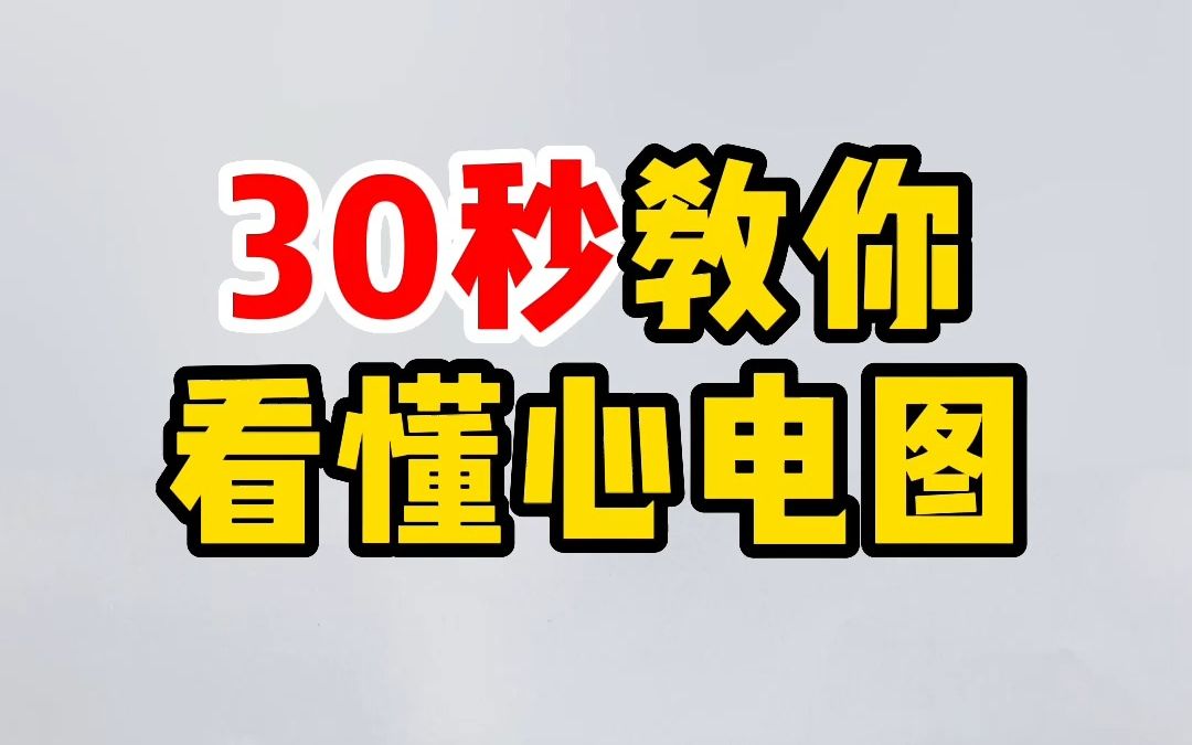 心电图怎么看,30秒教会你哔哩哔哩bilibili