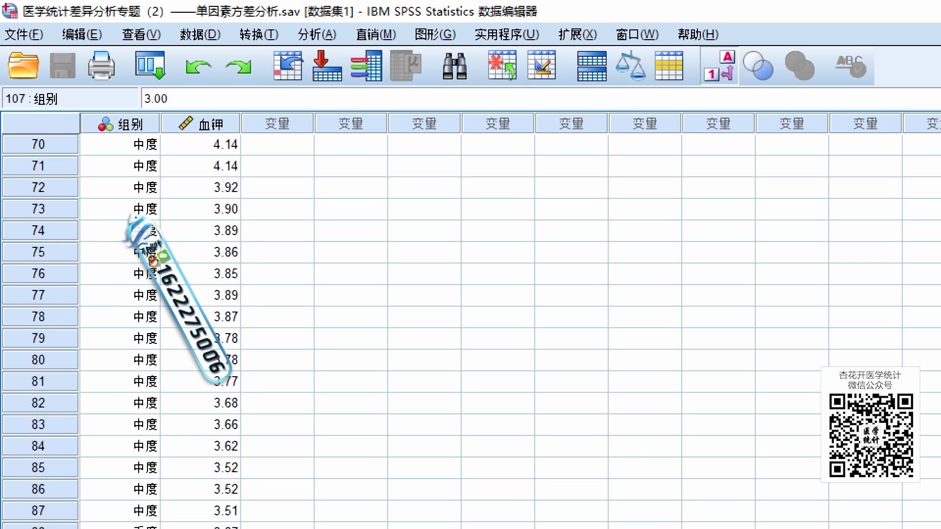 [图]SPSS医学统计高能方法：单因素方差分析（One Way ANOVA）——【杏花开医学统计】