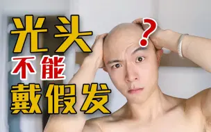 Download Video: 脱发后剃了光头，如果戴假发该怎么选？弄什么发型？