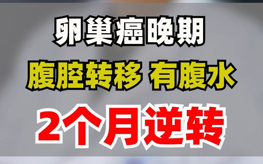 卵巢癌晚期,腹腔转移有腹水,2个月逆转哔哩哔哩bilibili