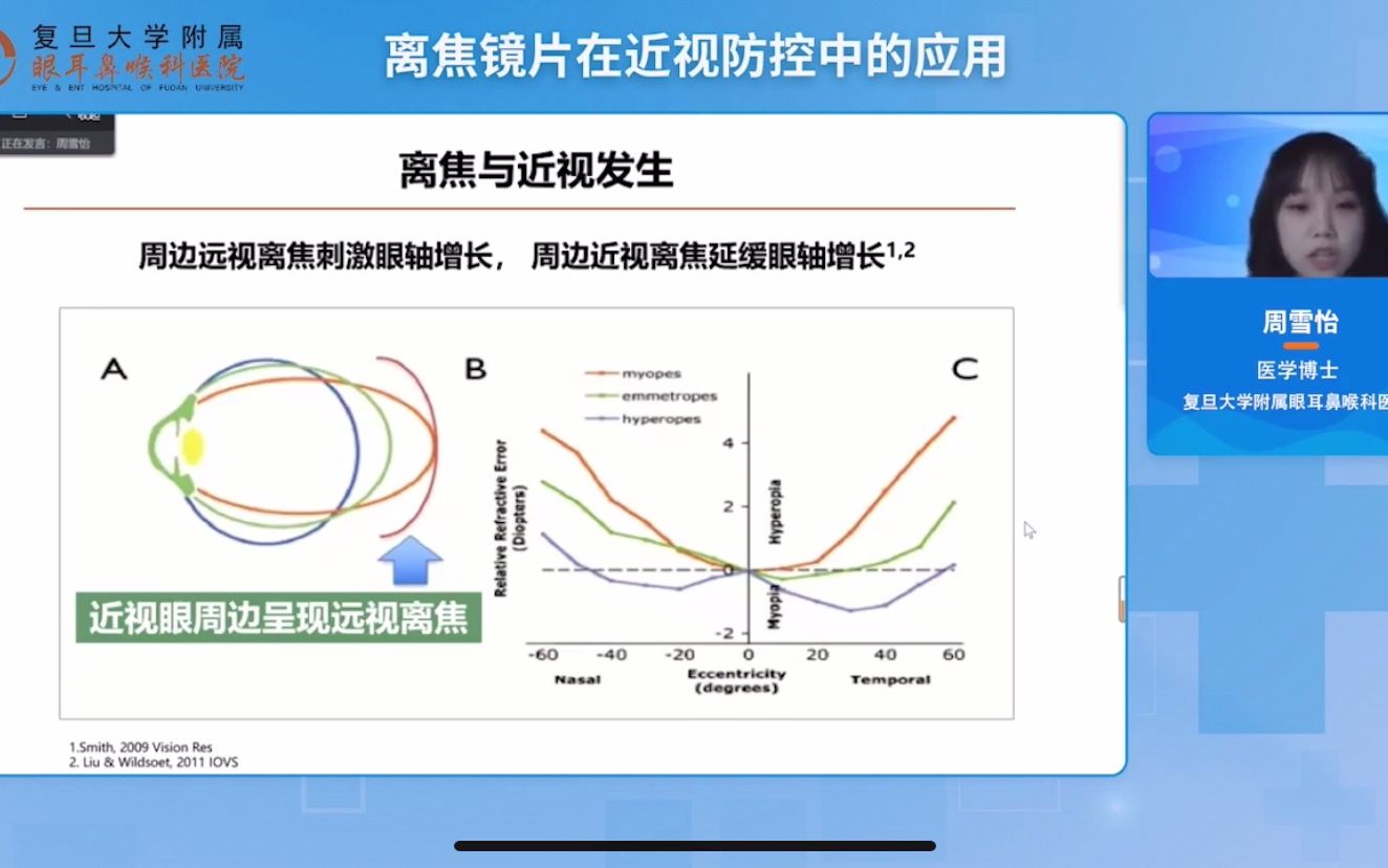 《视光门诊的综合诊疗》第8集:离焦镜片在近视防控中的应用哔哩哔哩bilibili