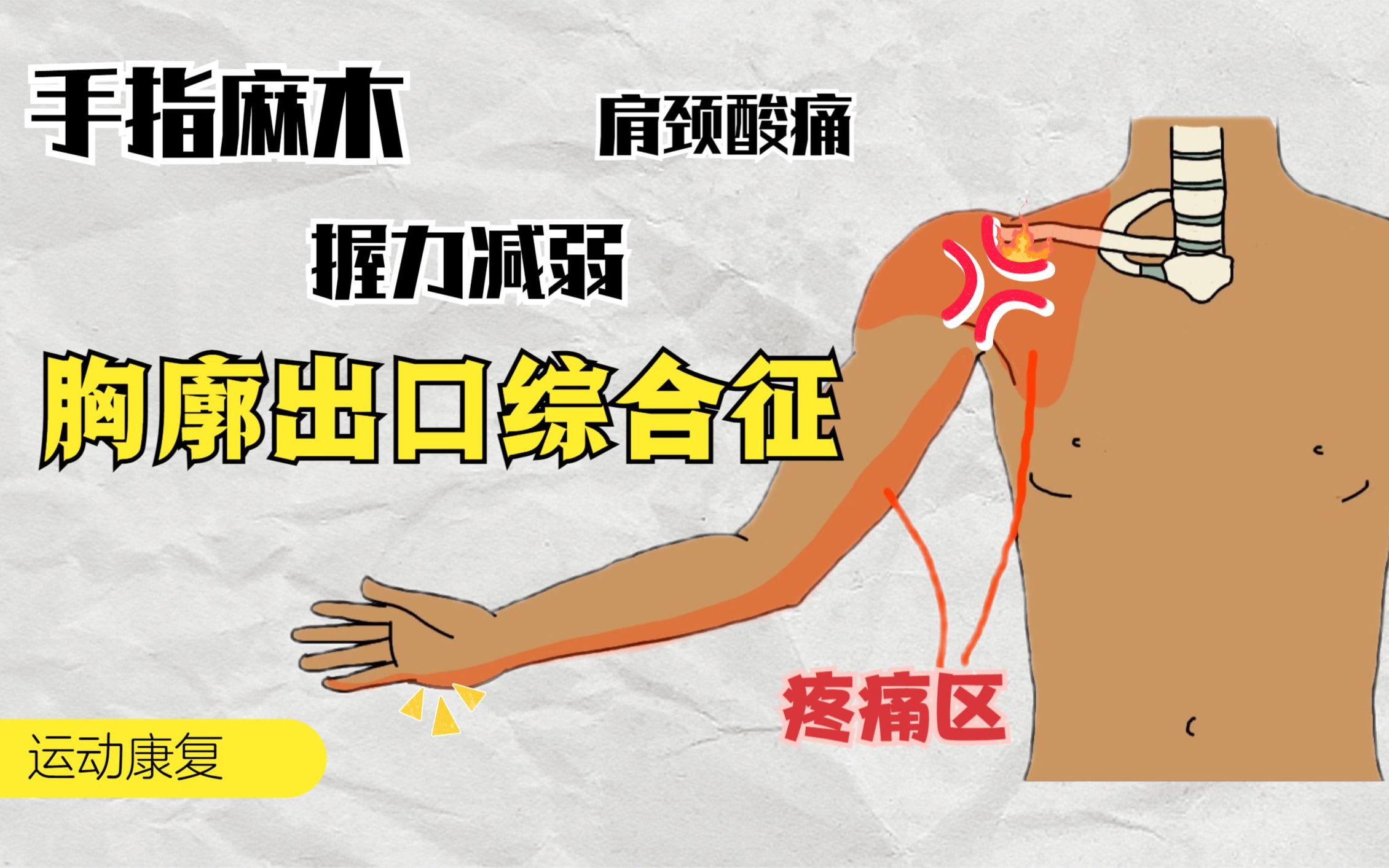 手麻腕无力,每天转动49下,放松紧张肌肉,消除手臂疲劳,手有力-镜子吱吱吱-腱鞘炎-哔哩哔哩视频