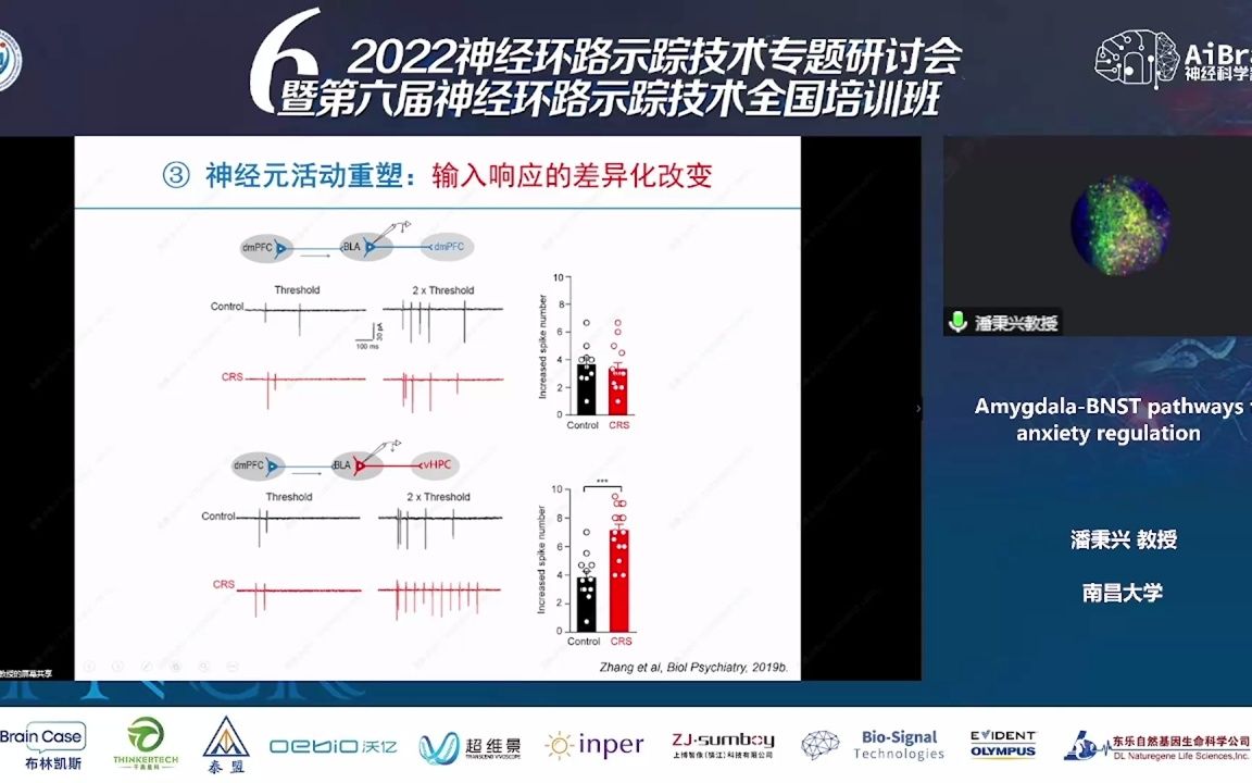 潘秉兴-amygdala-bnst pathways for anxiety regulation