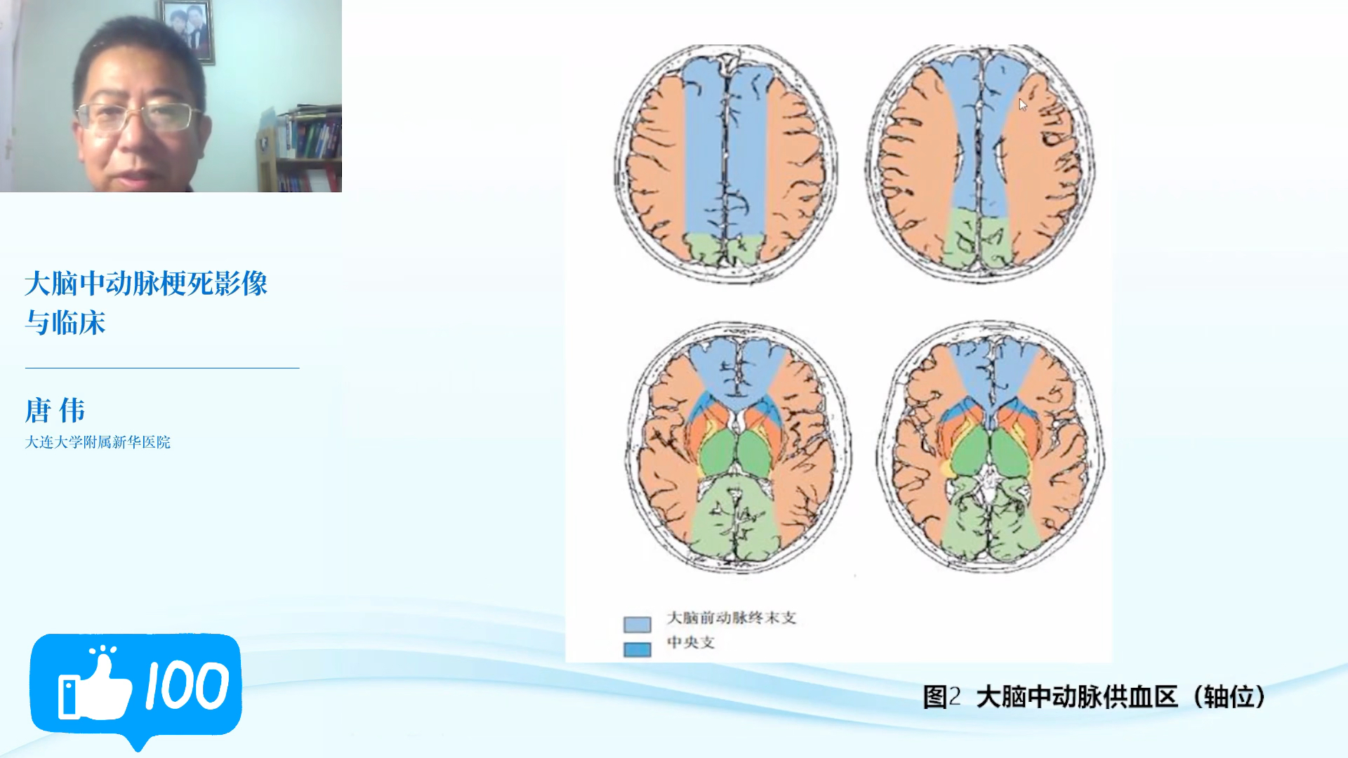 [图]2023年更新梅斯神内：003唐伟：脑血管病影像与临床（已完结）——17大脑中动脉梗死影响与临床