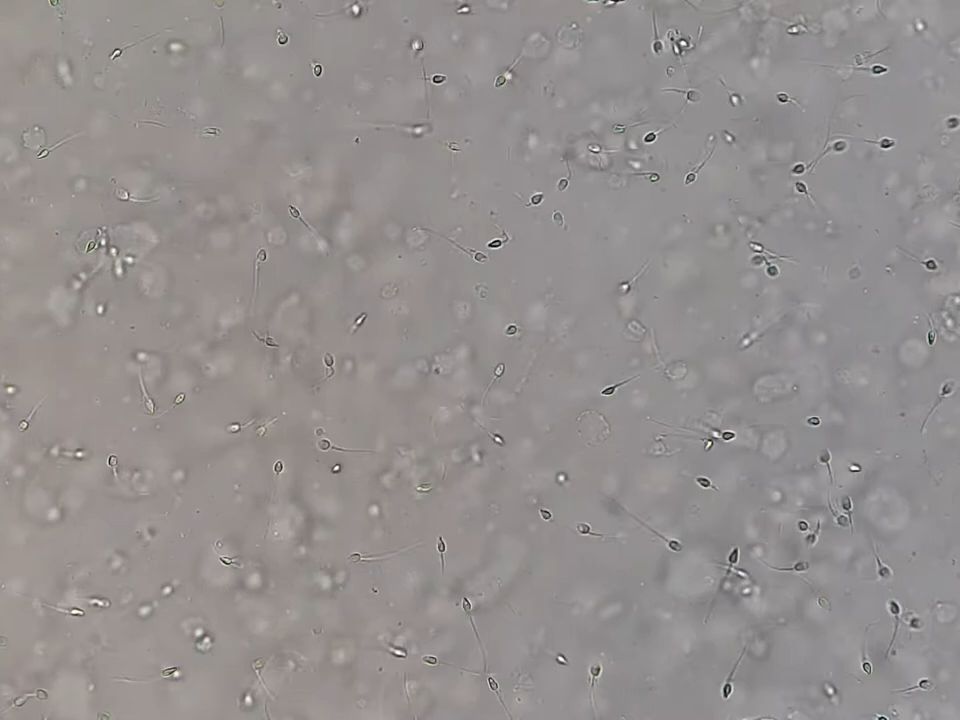 显微镜 精子标本制作图片
