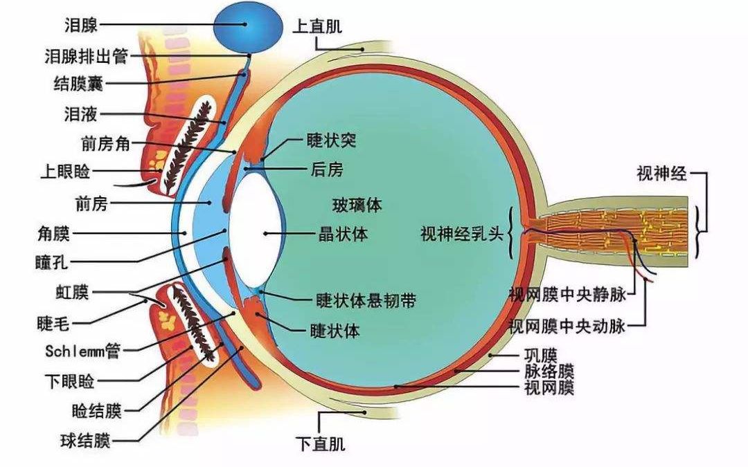 模糊的世界白内障