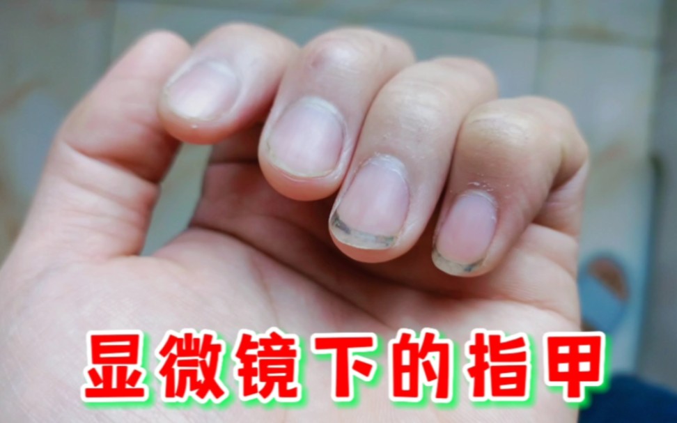 指甲长时间不清理能有多脏?显微镜下放大后,小伙被吓到了!
