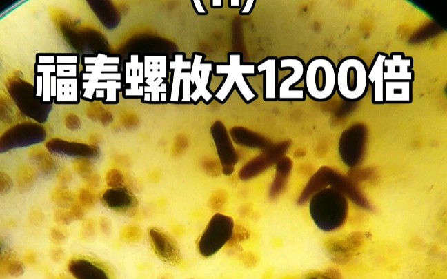 第11集 福寿螺放大1200倍,发现密密麻麻的寄生虫,好可怕!