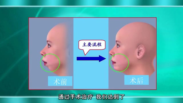 [图]走进口腔的数字化技术__浙江工业大学