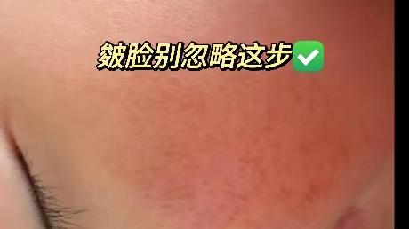 孩子皴脸这一步98%的宝妈都忽略了!