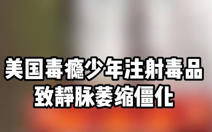 美国毒瘾少年:“我从17岁开始使用毒品,真不敢相信我这样糟蹋自己的人生”哔哩哔哩bilibili