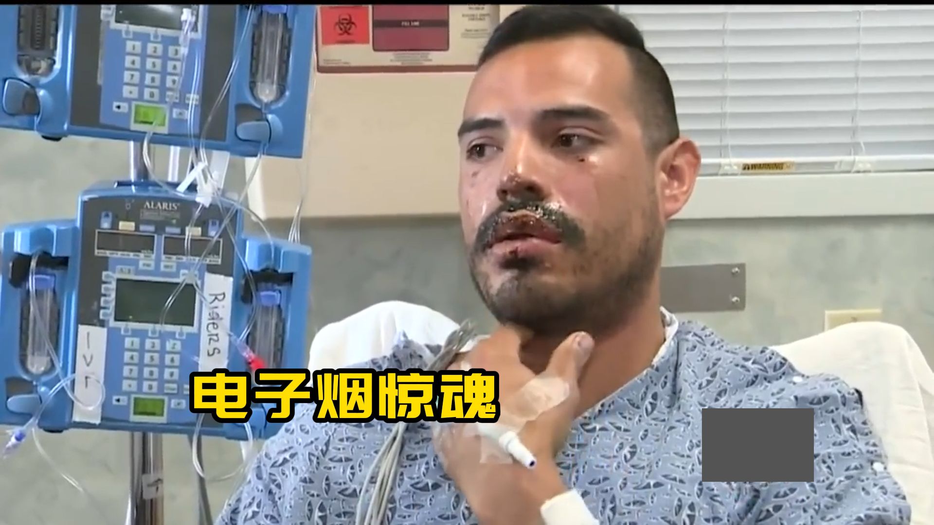 国外小伙的一场电子烟惊魂