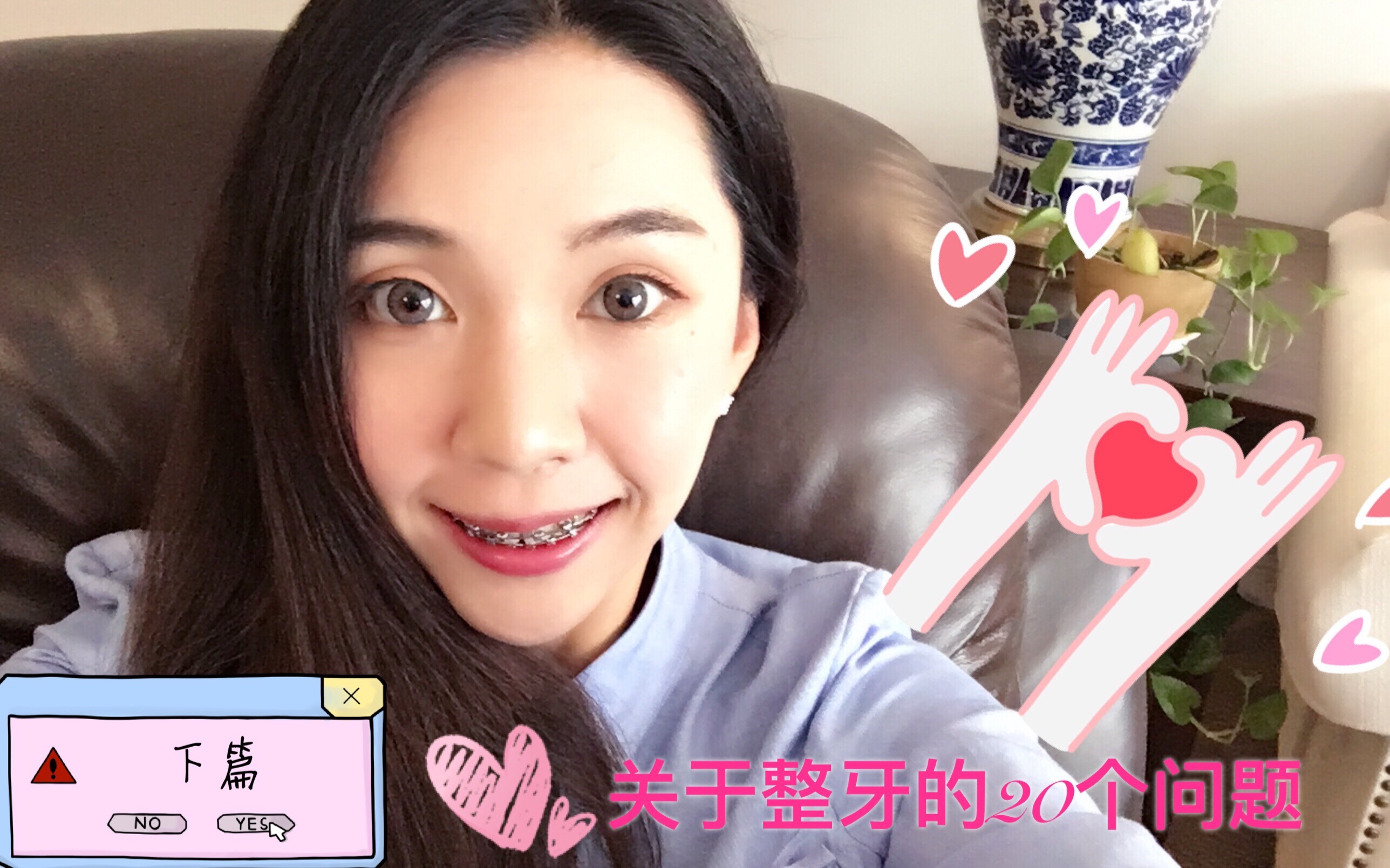 [关于戴牙套的20个问题下篇]Braces girl的经验分享,满满干货哔哩哔哩bilibili