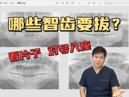 Download Video: 聊聊智齿，哪些要拔？哪些不用拔？